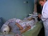 Від махінацій медиків у столичній клініці постраждали півсотні хворих на гепатит С