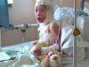 На Ивано-Франковщине 4-летняя девочка получила ожог 65% тела