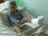 На Волині дитина впала з висоти 4 поверху й вижила