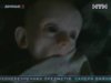 В Донецке равнодушие родителей и врачей едва не погубило ребенка