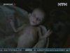 У Донецьку померла заморена голодом дівчинка
