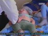 В Одесской области - вспышка дизентерии