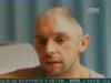 Британець живе без частини черепа
