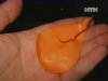У Ковелі дитина задихнулася через повітряну кульку