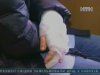 У Полтаві підозріла на сказ псиця покусала 43 людини
