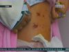 У Нью-Йорку ловлять скажених пітбулів