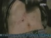 Хлопчика в Чернігові вбив підліток, і це не перша його жертва