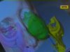3D-технології у пластичній хірургії