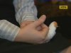 Киянку покалічили в салоні краси