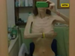 Юна вінничанка загинула через бажання схуднути