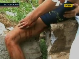 У Запоріжжі рятувальники визволили чоловіка з полону арматури