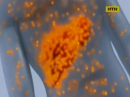 Гепатит С - як протидіяти лагідному вбивці