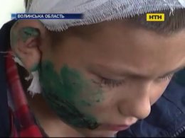На Волині бійцівський собака покусав 9-річного хлопчика
