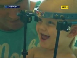 В Австралии успешно прооперировали малыша со сломанной шеей