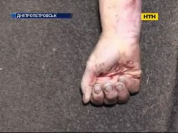 В Днепропетровске пенсионер зверски убил жену