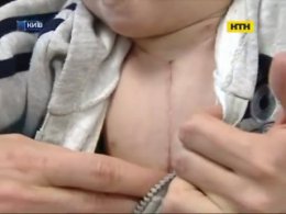 Столичні хірурги врятували хлопчика з унікальною патологією серця