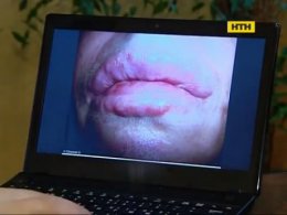 Вбивча краса - ін'єкції, що калічать
