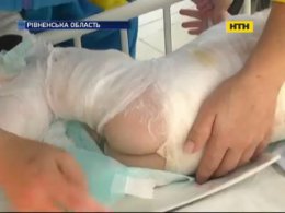 Дитина в небезпеці - як уберегти крихітку від опіків