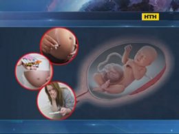 Столичные детские хирурги спасают младенцев со страшной патологией
