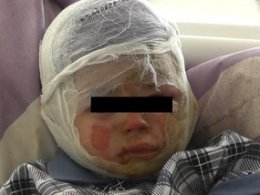 Російські колектори жбурнули коктейль Молотова до оселі боржника, постраждала дитина