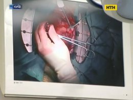 У столиці провели унікальну операцію на серці