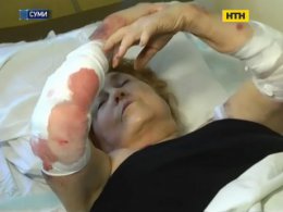 Бійцівський пес не вперше калічить людей в Сумах