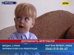 Родные 2-летнего Богданчика из Черновцов мечтают услышать его первое слово