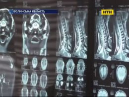 З'ясували, що хлопчик на Волині помер не від поліомієліту