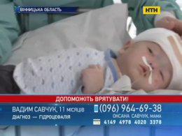 Малюк з Вінничини потребує допомоги, аби здолати гідроцефалію