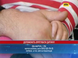 Маленька жертва лікарської помилки потребує допомоги