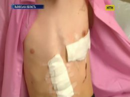 В районной больнице во Львовской области спасли подростка с пробитым сердцем