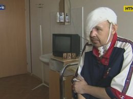 В Институте Шалимова медикам удалось пересадить пациенту пол-лица!