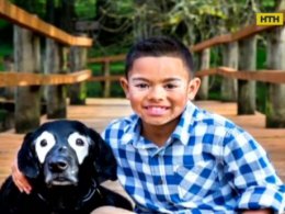 Хлопчик та пес з однаковим діагнозом - вітиліго - стали зірками американських таблоїдів