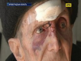 На Кіровоградщині односелець напав із сокирою на пенсіонерів