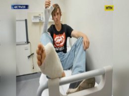 Унікальну трансплантацію провели в Австралії