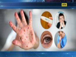 Відмова віж щеплень спровокувала спалах кіру в Україні