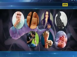 Спалах холери у Миколаїві - що потрібно знати, щоби не підчепити інфекцію