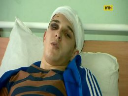 На Київщині 5 підлітків жорстоко побили хлопця