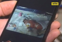 Четырехмесячная девочка погибла после осмотра окулиста в Запорожье