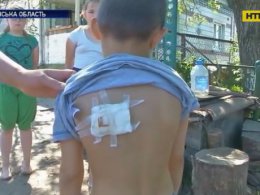 5-летний мальчик чуть не погиб от пули, играя в собственном дворе