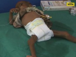 Наймасовіший голодомор в історії людства очікує жителів Ємену