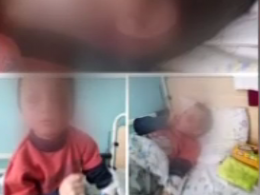 6-річний хлопчик з гематомами та синім обличчям потрапив до лікарні на Вінниччині