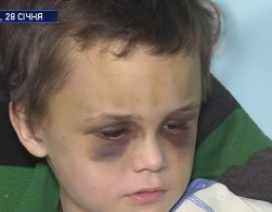6-річного Іванка, якого били батьки, вилучать із родини