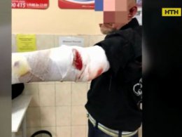 П'яний чоловік нацькував бійцівського пса на людей у супермаркеті