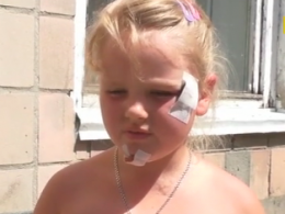 Агрессивный пес покусал 8-летнюю девочку в Луцке