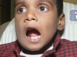 У роті 7-річного хлопчика з Індії виросло понад півтисячі зубів