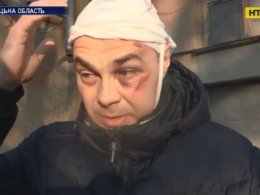 В Мариуполе таксист битой разбил голову пассажиру