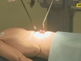 Хірурга-робота презентували у Львівській лікарні швидкої допомоги