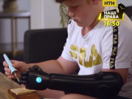 Ребенок, первым в Австралии, получил бионическую руку