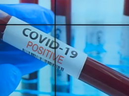 2656 украинцев заболели коронавирусом за прошедшие сутки